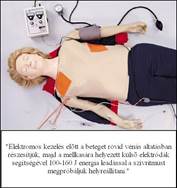 https://media.hazipatika.com/services/denc/images/0171_pitvarfibrillacio_2.jpg