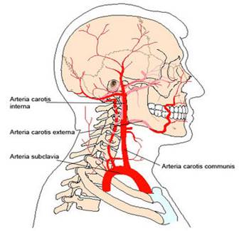 A csigolya-artériás szindróma és a nyaki osteochondrosis jellemzői