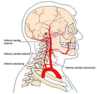carotis artéria és magas vérnyomás