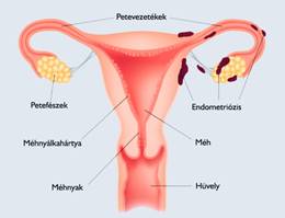 ízületi fájdalom a tamoxifen miatt)