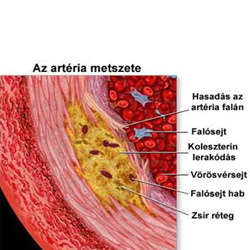 fitoszterolok a szív egészségére